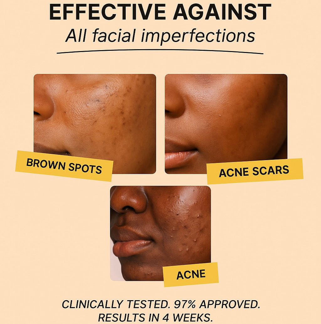 Anti-Imperfection routine