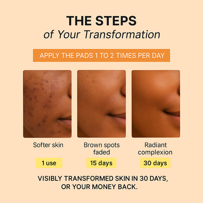 Anti-Imperfection routine